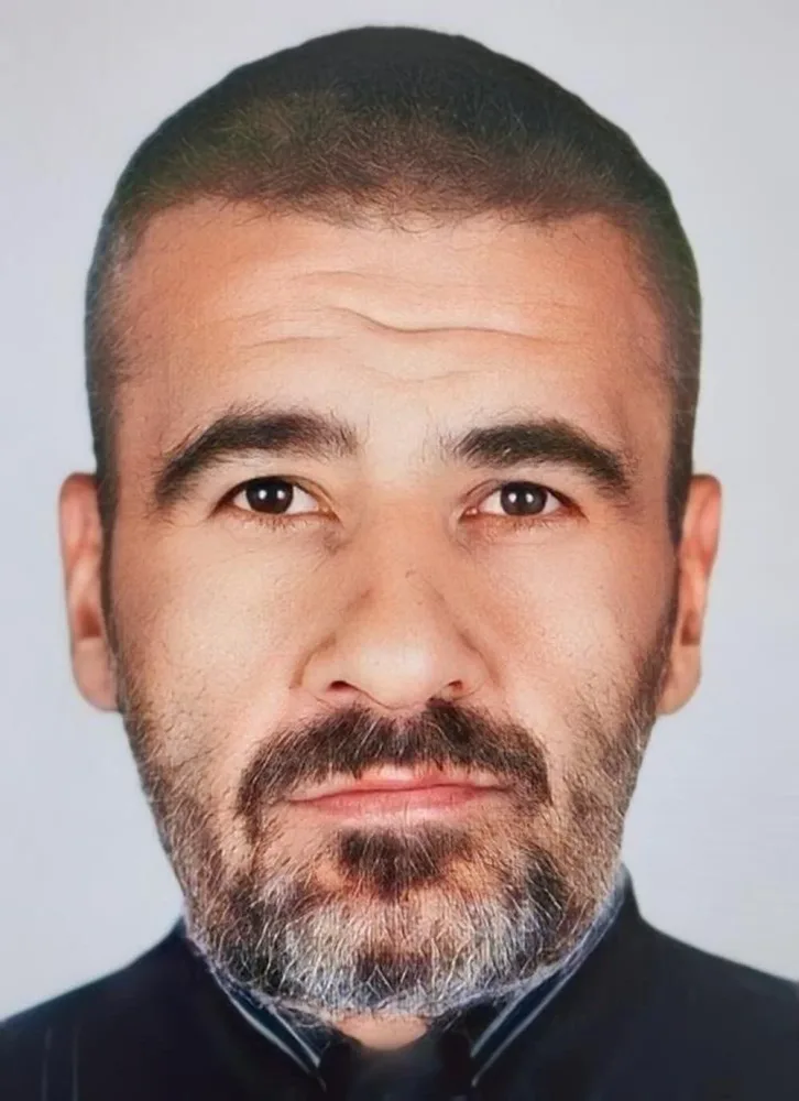 "İntihar etmək üçün əqrəb yedim" - FOTO