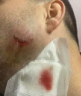 Çavuş tibb işçisini yumruqladı, sürücünü dişlədi - ŞOK HADİSƏ