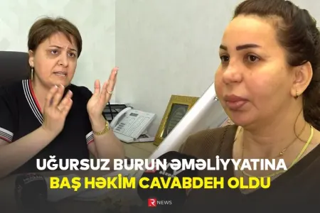 Uğursuz burun əməliyyatına baş həkim cavabdeh oldu - ÖZƏL