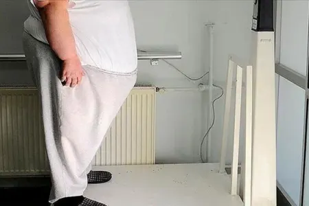 Türkiyə obezitəyə görə Avropada birinci yerdədir