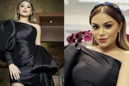 Türkanı LAĞA QOYDULAR: - “Elə bil, eşşək arısı vurub” – FOTOLAR