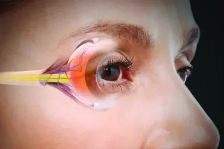 Təzyiq dərmanları ilə bağlı xəbərdarlıq - Gözə ziyan vura bilər