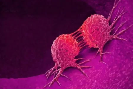 Yüksək hemoglobin səviyyəsi xərçəngə işarə edə bilər - – Açıqlama