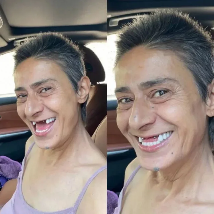 Yıldız Tilbe bu dəfə dişsiz fotosu ilə diqqət çəkdi