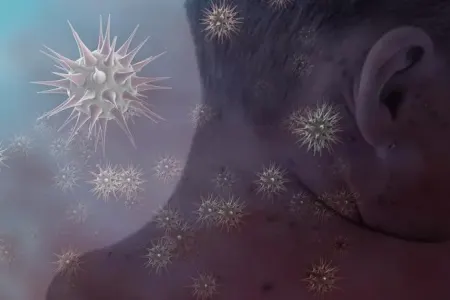 Qızılca epidemiyası: - 19 uşaq öldü