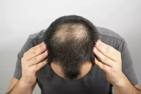 Bu içkilərdən uzaq durun, saçları tökür
