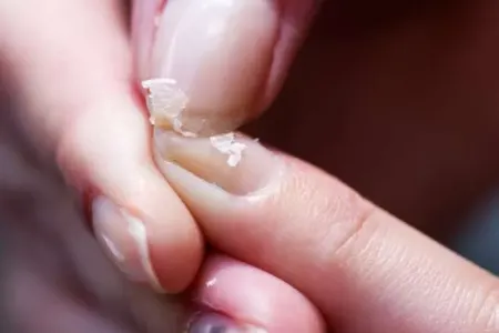 Dırnaqları uzatmağın 5 əsas təbii yolu