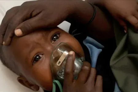 "Lassa" epidemiyası: - ÖLƏNLƏR VAR