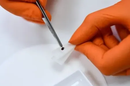 “Layme xəstəliyi ABŞ bioloji laboratoriyasından yarana bilər” - – Açıqlama