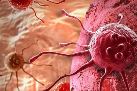 Xərçəngdən qorunmaq üçün 4 VACİB QAYDA