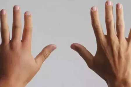 Bədənin hansı hissəsindəki şişkinlik nə mənayə gəlir? - – Bu halda həkimə müraciət edin!