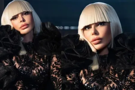 Aygün Kazımovanı bir də belə görün - – Fotolar