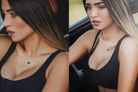 Renka qəzaya düşdü, rəqs edə bilməyəcək - – VİDEO