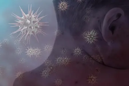 "Qızılca halları artmaqdadır"