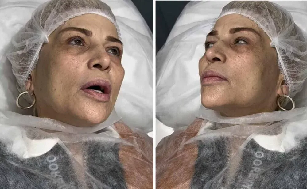 Mətanət İsgəndərlinin makiyajsız - FOTOsu yayıldı