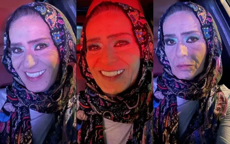 Yıldız Tilbenin yeni fotoları müzakirə yaratdı