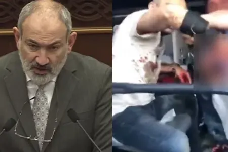 Paşinyan barmaqları qopan etirazçıdan danışdı: - "Özü əlinə götürüb!"