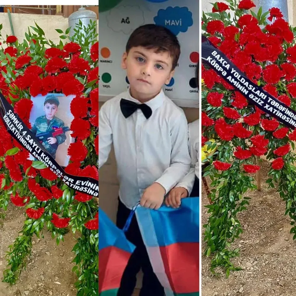 Faciəvi şəkildə ölən 5 yaşlı Aminin - FOTOSU