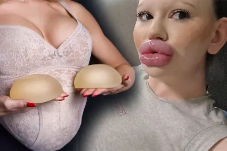 Silikonlu nənələr - ÖZƏL VİDEO