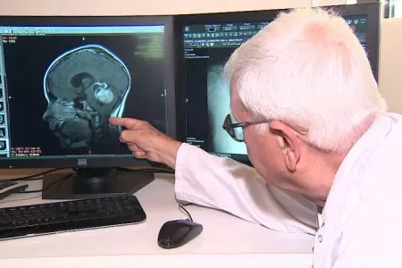 Bu şəxslərin xərçəngə tutulma riski daha yüksəkdir