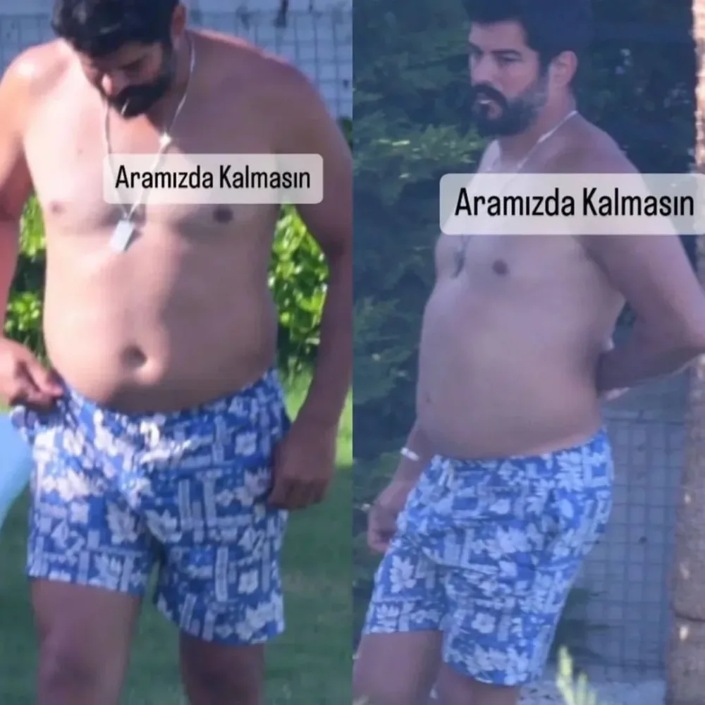 Burak Özçivitin göbəyi pərəstişkarlarını MƏYUS ETDİ - FOTO