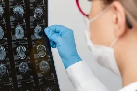 Beyin xərçənginin yeni müalicə üsulu tapıldı