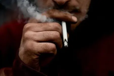Çəkdiyi siqaret özünü yandırdı