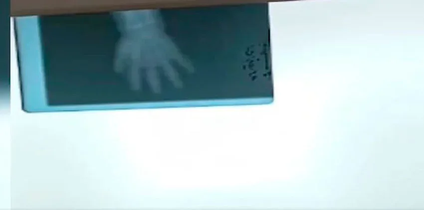 Azyaşlı uşağın əli ətçəkən maşında qaldı - FOTO