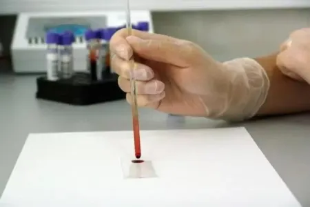 Orqanizmdə niyə dəmir yoxdur?