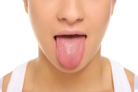 Ağızda quruluq bu 5 ciddi xəstəliyin əlamətidir