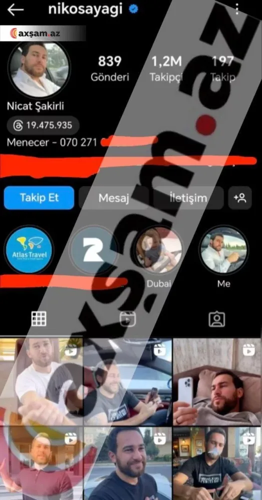 “Nikosayağı”dan gözlənilməz - ADDIM - FOTOlar