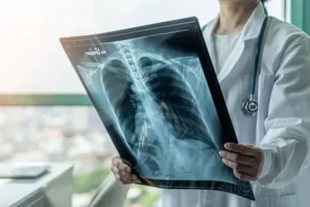 Alimlər: Fil suitilərinin qanı ağciyər xəstəlikləri ilə mübarizə aparmağa kömək edəcək