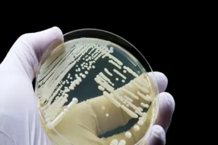 Orqanizm üçün ən təhlükəli göbələk aşkar edildi