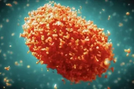 Bu ölkədə də meymunçiçəyi - xəbərdarlığı