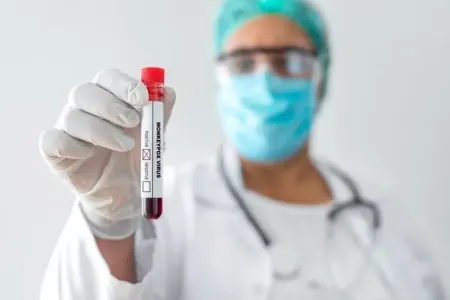 Meymunçiçəyi pandemiyaya çevriləcək? - ÜST-dən vaksin tövsiyəsi