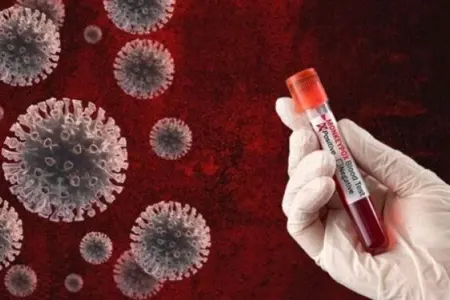 Ankarada meymunçiçəyi virusu - AŞKARLANDI?