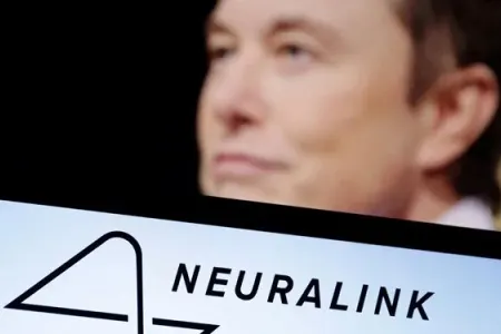 İlon Mask milyonlarla insana beyin çipi - yerləşdirmək istəyir