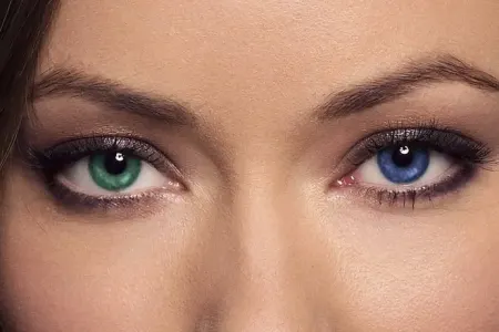 Göz rənginin dəyişdirilməsi əməliyyatı qadağan dilməlidir, insanlar kor olur