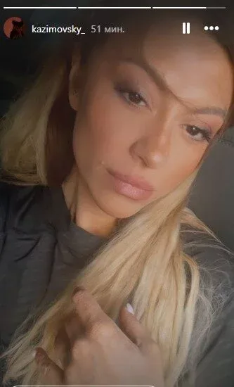 Aygün Kazımovanın qızı tanınmaz halda