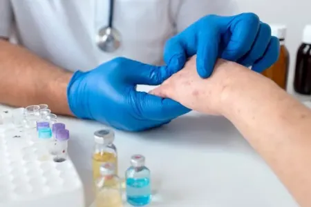 Qızılcaya yoluxanların sayı artdı