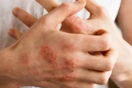 Azərbaycanda qoturların sayı beş dəfə artıb