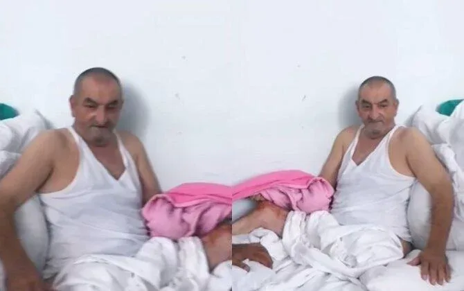 Aktyorun ayağı yanlış amputasiya edilib? - Klinikadan AÇIQLAMA