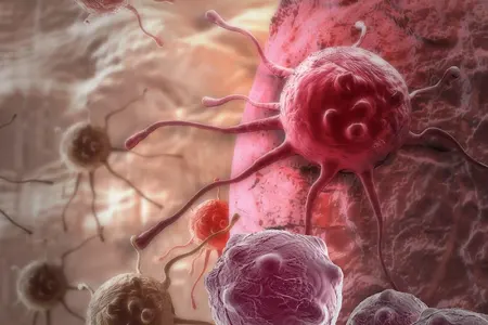 Gənclər arasında qorxulu göstəricilər - – Bu qidalar xərçəng riskini artırır