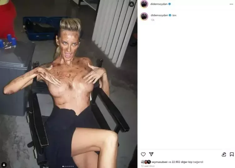 Məşhur model bu görüntüsü ilə şok etdi