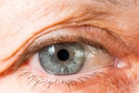 Görmənin pisləşməsi demans riskini artıra bilər