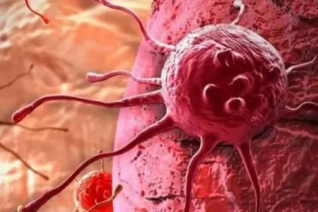 Xərçəngi sağaldan MÖHTƏŞƏM RESEPT