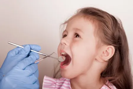 Dişlərin çürüməsinin qarşısını almağın üsulu məlum oldu