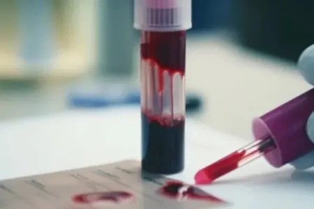 İnsanın qanı ilə xəstəlik və ölüm risklərini öyrənə biləcəklər - Alimlərdən İLK!