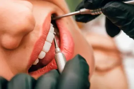 Dişləri ən çox ləkələyən qidalar hansılardır?