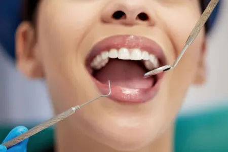 İnsanda yenidən diş çıxaran preparat hazırlandı